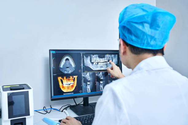 Best Emergency Tooth Extraction in Lyons, OR