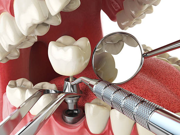 Best Cosmetic Emergency Dentistry in Lyons, OR